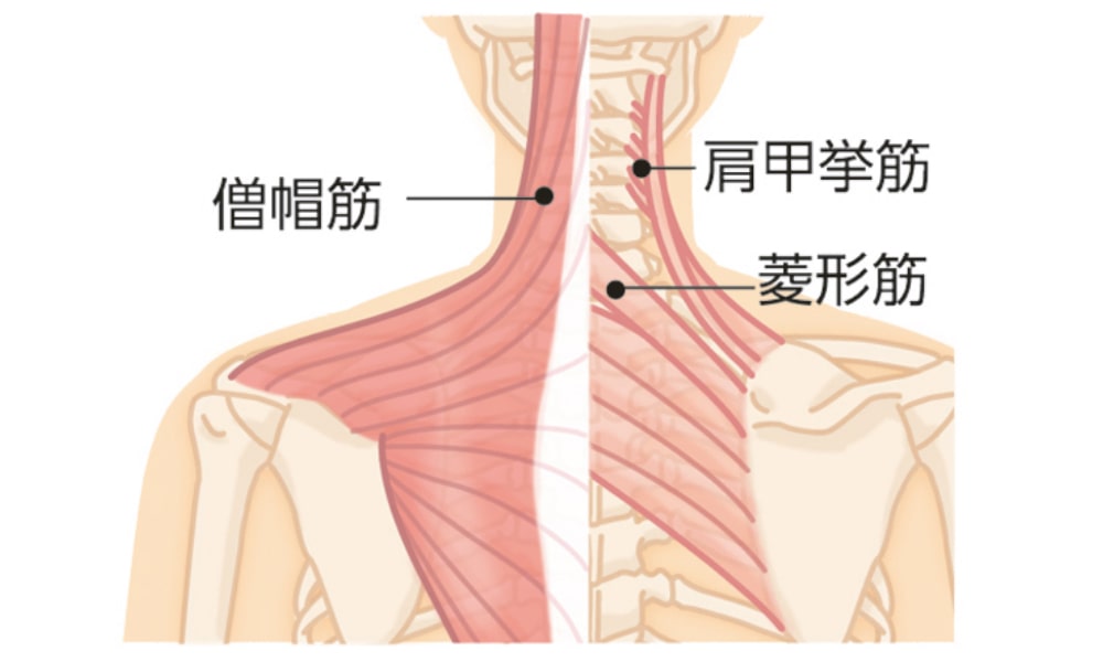 寝違えの筋肉